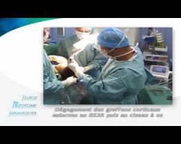 CMF - Cranial Surgery, Dr Solyom